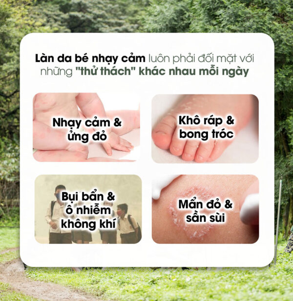 Kem Dưỡng Phục Hồi Ngải Cứu 50g - Ảnh 4